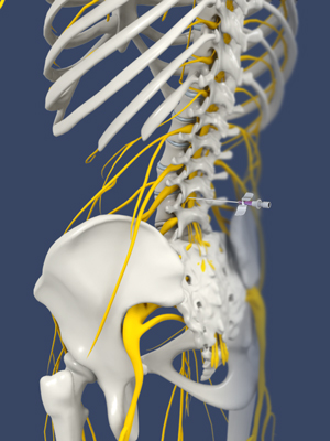 Lumbar Sympathetic Block