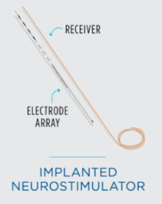 Peripheral Nerve Stimulation